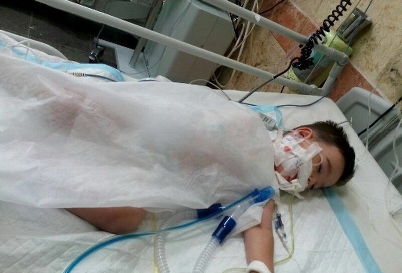 کودک ۴ ساله ارومیه‌ای بر اثر سوختگی ناشی از اسید جان باخت