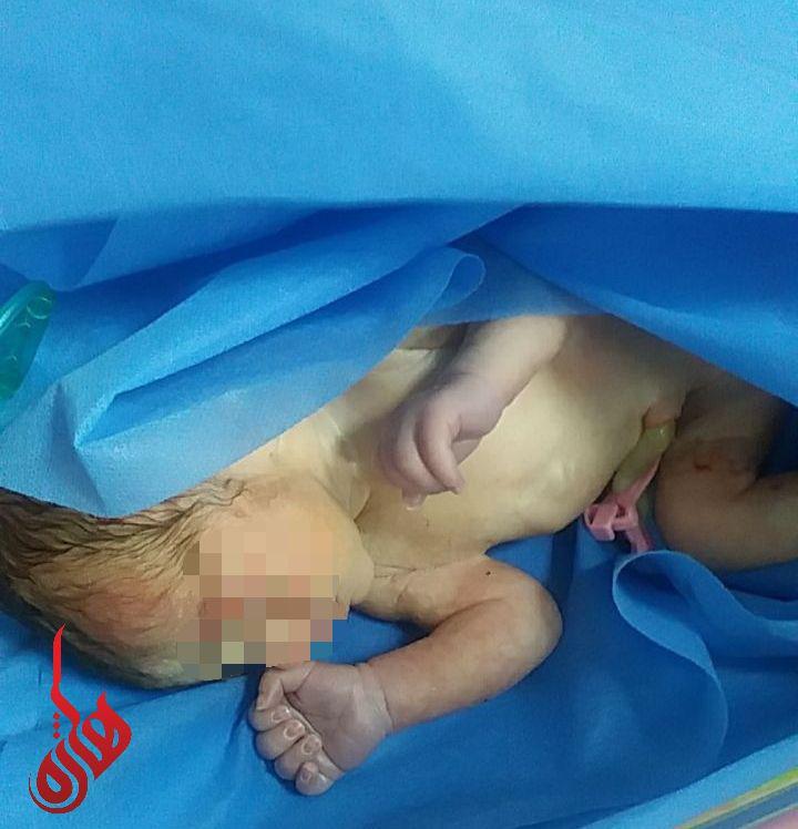 پیدا شدن نوزاد تازه متولد شده در یکی از محلات مهاباد