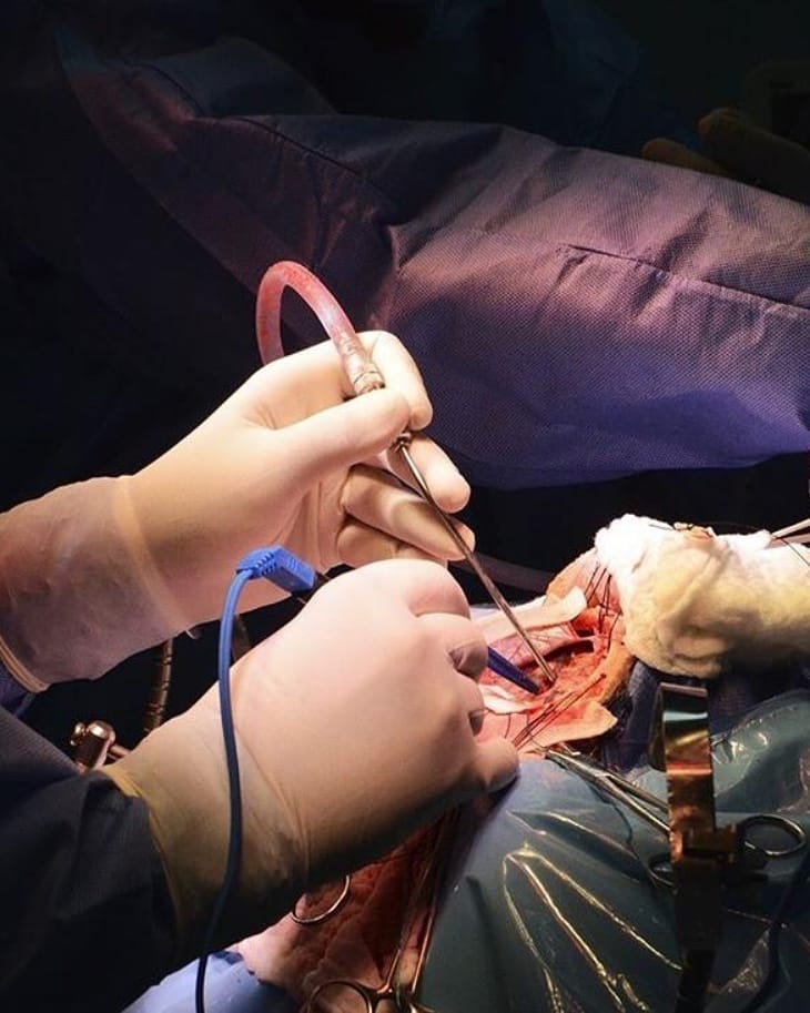 نخستین عمل جراحی شکستگی جمجمه در بوکان انجام شد